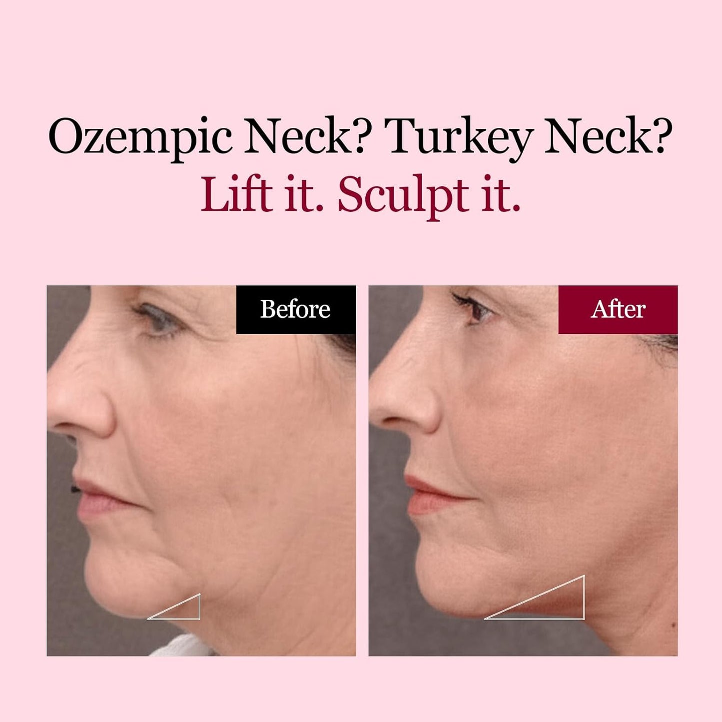 Collagen V line lifting Mask 4PCS Slimming Firming Moisturizing Skincare Face Mask