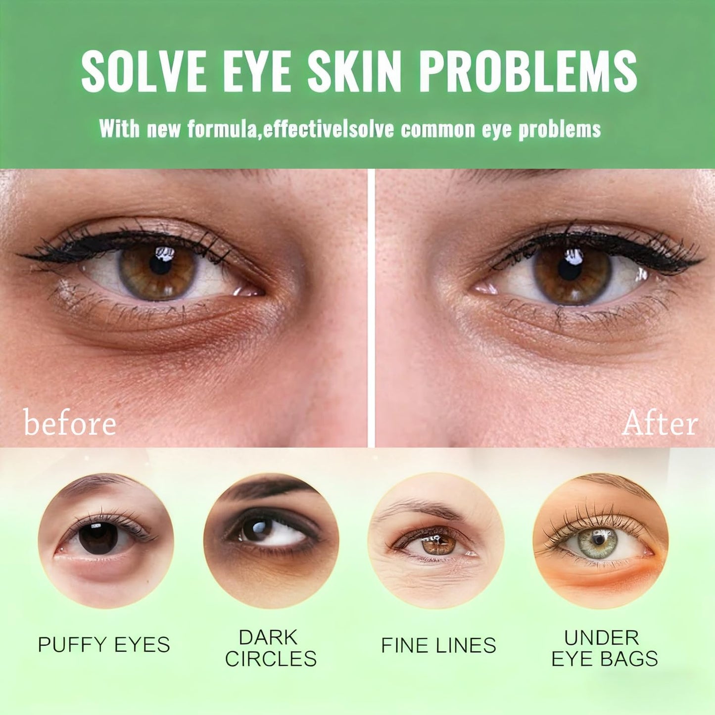 Avocado Under Eye Patches(30 Pairs),Under Eye Mask for Dark Circles, Puffy Eyes,EyeBags and Fine Lines
