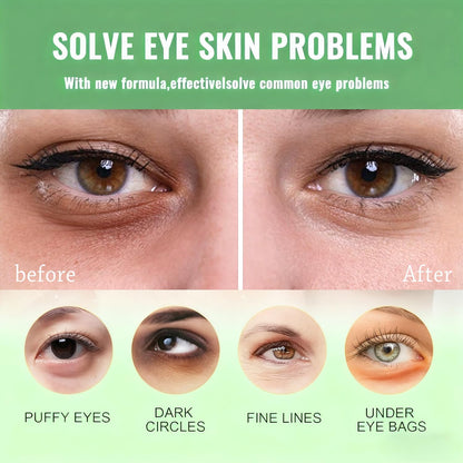 Avocado Under Eye Patches(30 Pairs),Under Eye Mask for Dark Circles, Puffy Eyes,EyeBags and Fine Lines