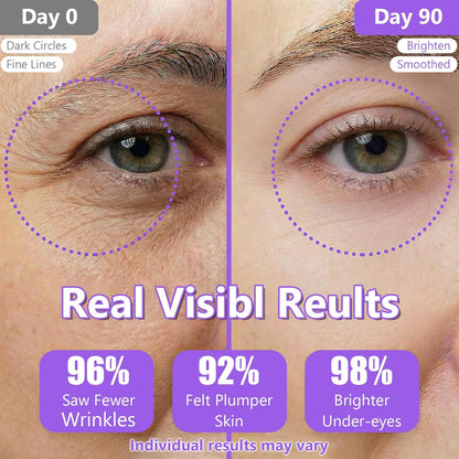 No.9 Eye Cream NAD+Volumetox (Retinol Eye Cream and Eye Serum)
