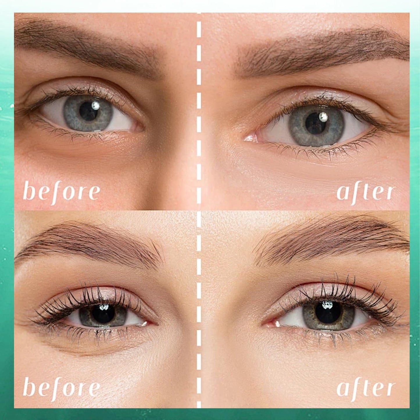 Avocado Under Eye Patches(30 Pairs),Under Eye Mask for Dark Circles, Puffy Eyes,EyeBags and Fine Lines