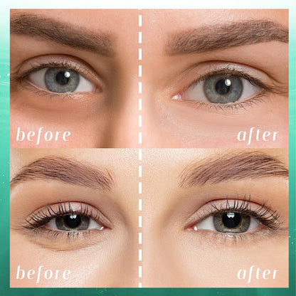 Avocado Under Eye Patches(30 Pairs),Under Eye Mask for Dark Circles, Puffy Eyes,EyeBags and Fine Lines